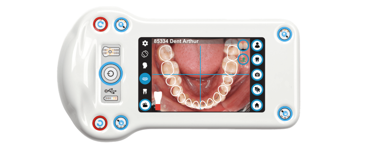 dental-camera-dentaleyepad-fits-all-hands-animation