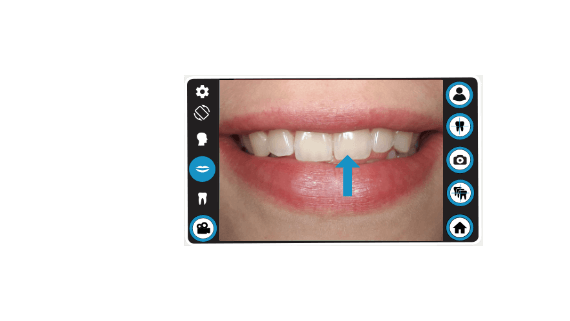 dental-camera-dentaleyepad-perfect-smile-animation-teeth-modus