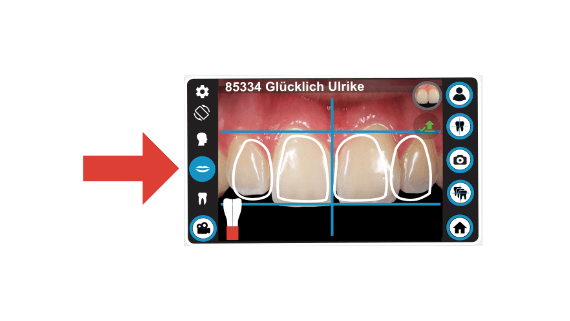 dental-camera-dentaleyepad-zoom-assistant-screen-smile