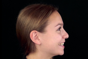 dentaleyepad Beispielfoto Portrait von schräg links