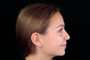 dentaleyepad Beispielfoto Profil von rechts entspannt