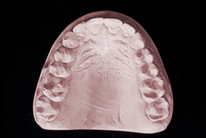 dentaleyepad Modell Oberkiefer