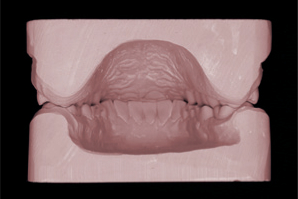 dentaleyepad Modell Rückseite