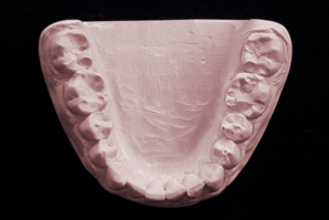 dentaleyepad Modell Unterkiefer