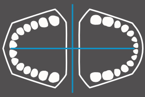 dentaleyepad Overlay Modell Ober- und Unterkiefer