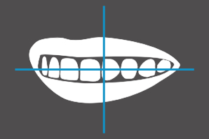 dentaleyepad overlay offenes Lächeln von links
