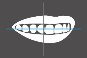 dentaleyepad overlay offenes Lächeln von rechts