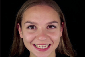 dentaleyepad beispielfoto Portrait von vorne offenes Lächeln
