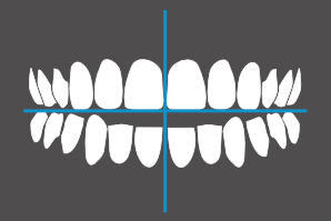 dentaleyepad overlay Front geöffnet mit Wangenhalter