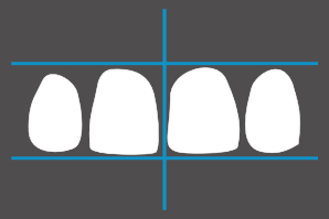 dentaleyepad overlay Oberkiefer Front