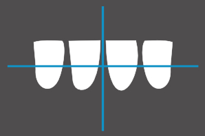 dentaleyepad overlay Unterkiefer Front