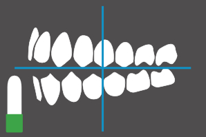 dentaleyepad overlay bukkal links geöffnet gespiegelt