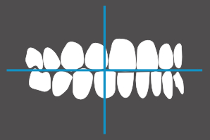 dentaleyepad overlay schräg von rechts geschlossen